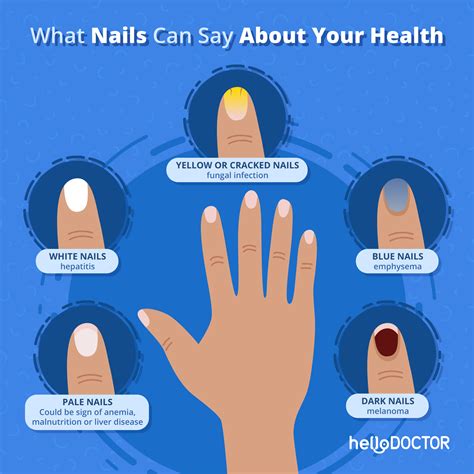 Nail Health 101: How Magic Nails Benefit Your Natural Nails in Wethersfield, DT